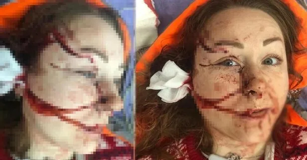 Boşanmak istediği kocası yüzünü falçatayla parçalayan Ukraynalı Hanna’dan haber var!