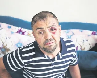 Bursa’da Gazi Ömer Karaman saldırıya uğradı, sosyal medyadan tepki yağdı