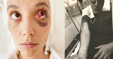 Deniz Bulutsuz’a şiddet uygulayan Ozan Güven için ‘tutuklansın’ talebi! Delilleri karartma şüphesi…