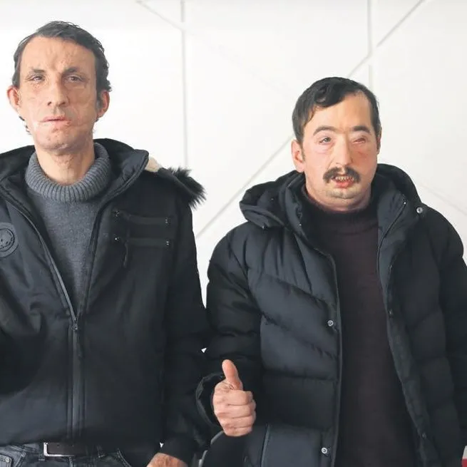 Gururlu’yüz’!