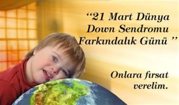 down-sendromu-nedir-21-mart-dunya-down-sendromu-gunu-mesajlari-ve-sozleri-1584784183860.jpg Down Sendromu nedir? 21 Mart Dünya Down Sendromu Günü mesajları ve sözleri!-1