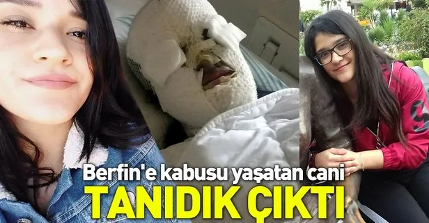 Berfin Özek’in yüzüne sıvı atan saldırgan eski nişanlısı çıktı