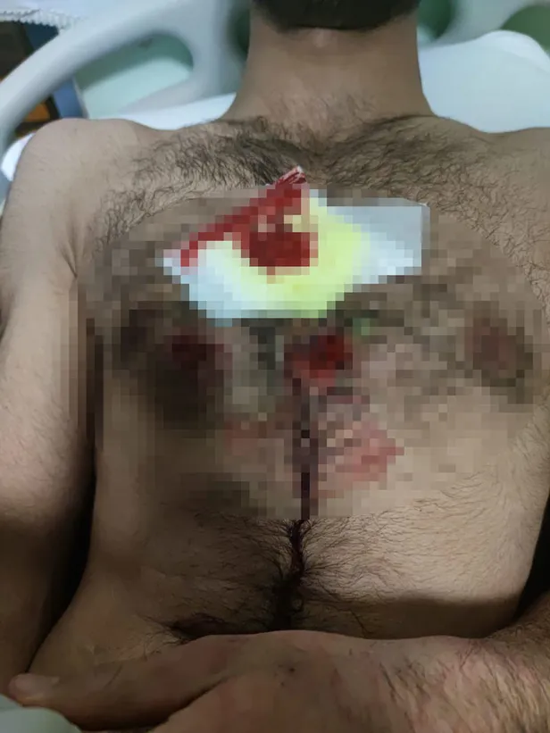 yunan-polisi-gocmenleri-plastik-mermilerle-yaraladi-1653548708511.jpg Yunan polisi göçmenleri plastik mermilerle yaraladı!-3