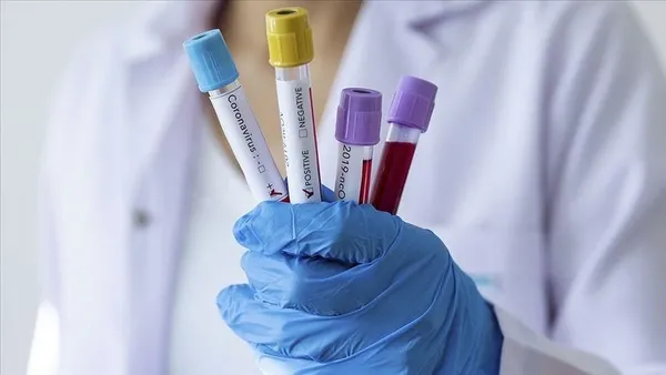 son-dakika-koronavirus-estonyada-da-goruldu-dunya-diken-ustunde-1582791135206.jpg Son dakika: Koronavirüs Estonya'da da görüldü! Dünya diken üstünde-1