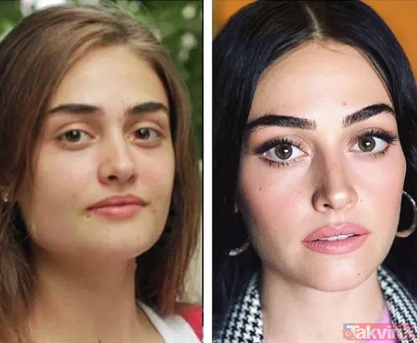 Burcu Özberk'in estetiksiz hali sosyal medyayı dile getirdi - 32