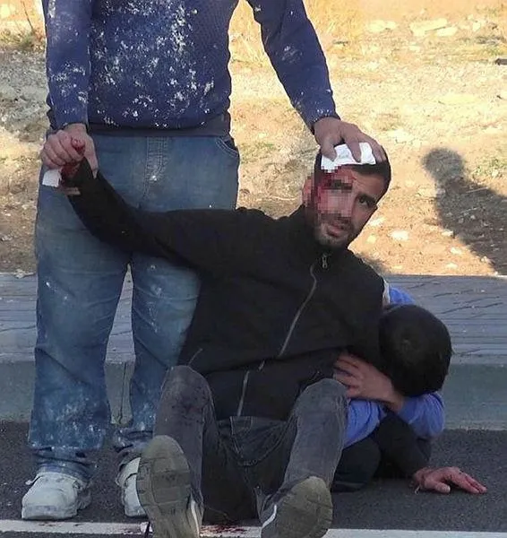 Erzurum Palandöken'de düğün öncesi kısır gecesi hazırlığında kavga: Yaralılar var-3