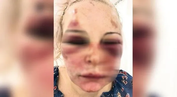 SON DAKİKA: Rus kadın otel odasında dehşeti yaşadı! "Tadı ne güzelmiş"-2