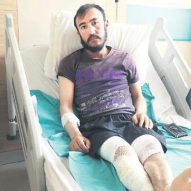 Hayvanları otlatırken yıldırım çarptı vücudu yandı: Bazen yaşadığıma inanamıyorum!