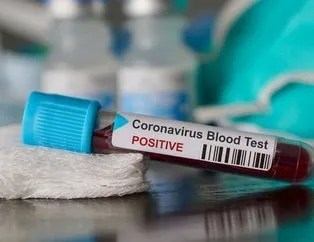 Corona virüs testi yapan devlet hastaneleri hangileri? Corona virüs testi online yapılıyor mu, ücretli mi?