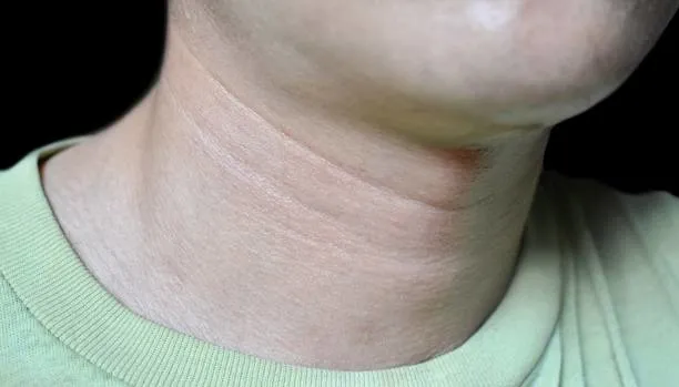 boyun-seklinize-gore-kisiliginiz-ortaya-cikiyor-meger-kisa-boyunlu-olanlar-1691849831131.jpg Meğer kısa boyunlu olanlar... Boyun şeklinize göre kişiliğiniz ortaya çıkıyor!-5