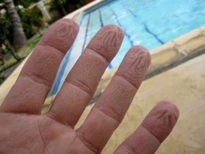 Parmaklar suda neden buruşur? İşte mucizenin cevabı