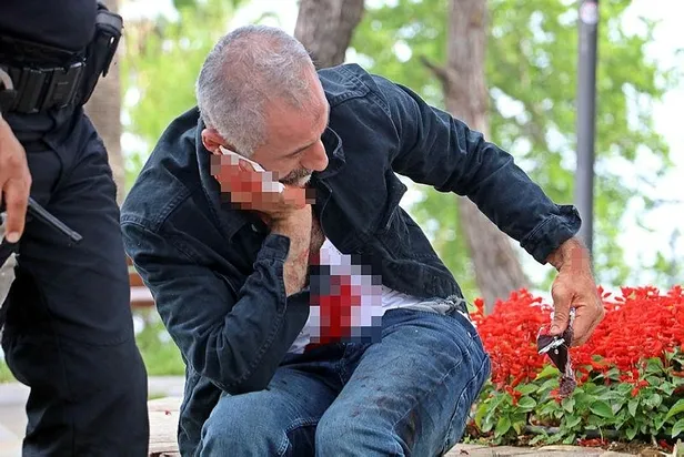 antalyada-polisin-kimlik-sordugu-sahis-bogazini-kesti-kanallara-ciksin-da-insanlar-beni-iyi-tanisin-1619366467289.jpeg Antalya'da polisin kimlik sorduğu şahıs kendini neşterledi! "Kanallara çıksın da insanlar beni iyi tanısın"-2