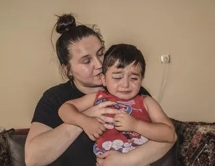 Köpekler 3 yaşındaki çocuğun yüzünü parçaladı