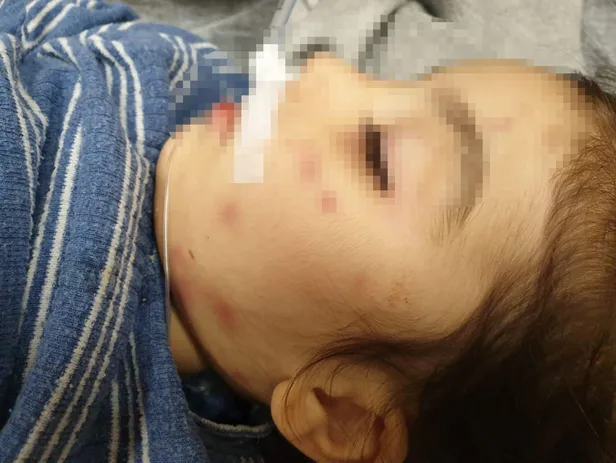 Adana'da isyan ettiren olay! 'Üzerine motosiklet düştü' denilmişti, gerçek ortaya çıktı-4