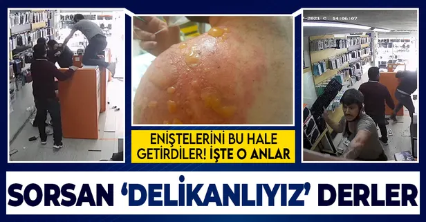 Kız kardeşlerinden boşanmasını istedikleri eniştelerini 40 dakika dövdüler! Kaynar su döktüler