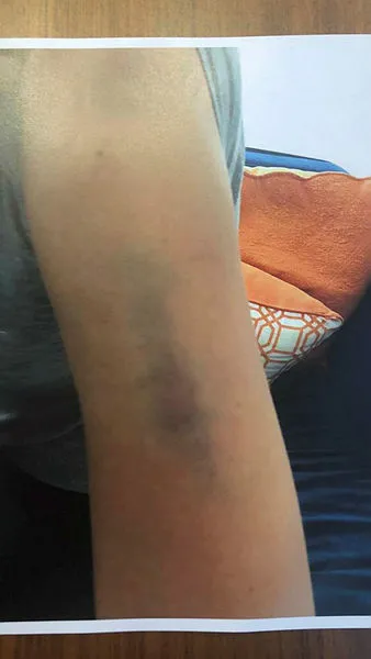 Ahmet Kural'ın Sıla'ya uyguladığı şiddetin fotoğrafları ortaya çıktı-2