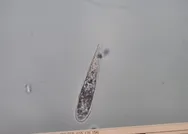 Müsilaj neden olur? İstanbul Üniversitesi ilk incelemesini tamamladı! Çarpıcı pandemi etkisi