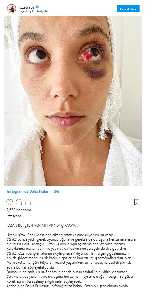 Halit Ergenç'ten Deniz Bulutsuz'u acımasızca darp eden Ozan Güven'e skandal destek!-7