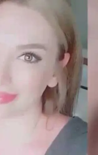 İstanbul'da botoks sonrası ölüm iddiası!