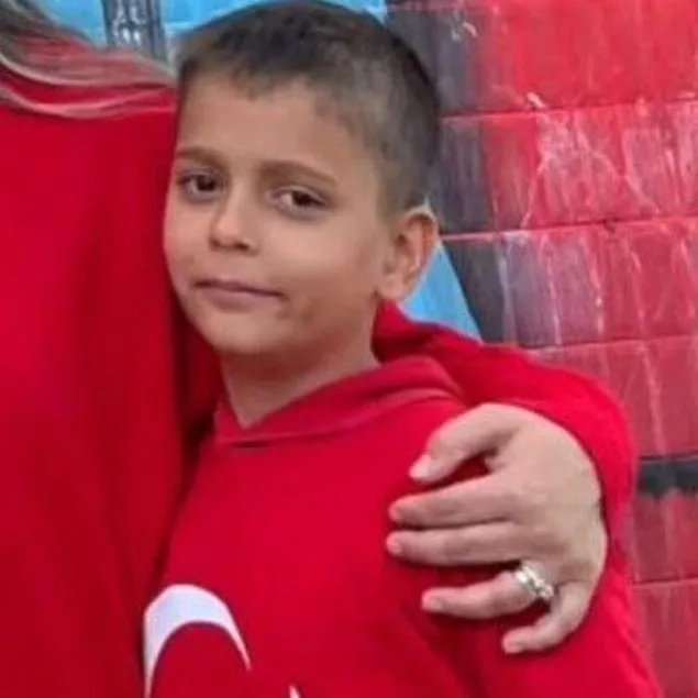 Üzerine kolonya döküp ateşe vermişti