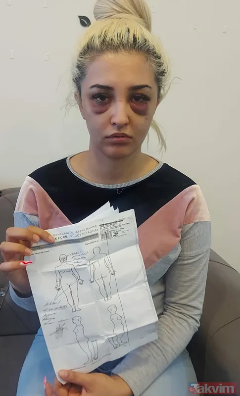 Eski sevgilisine dehşeti yaşattı: Ayrılmayı kabul etmedi 3 saat boyunca darp ederek tanınmaz hale getirdi! - 10