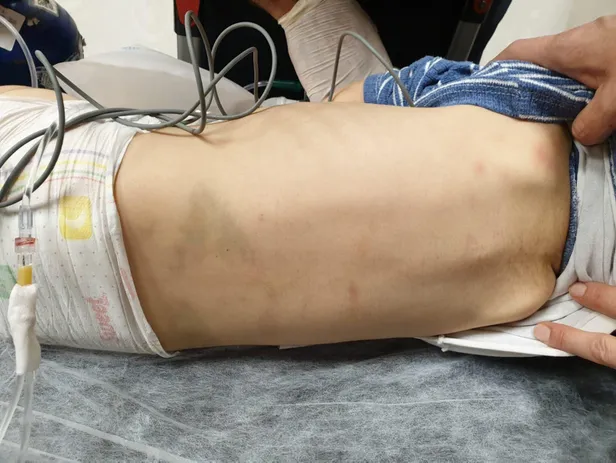 Adana'da isyan ettiren olay! 'Üzerine motosiklet düştü' denilmişti, gerçek ortaya çıktı-7