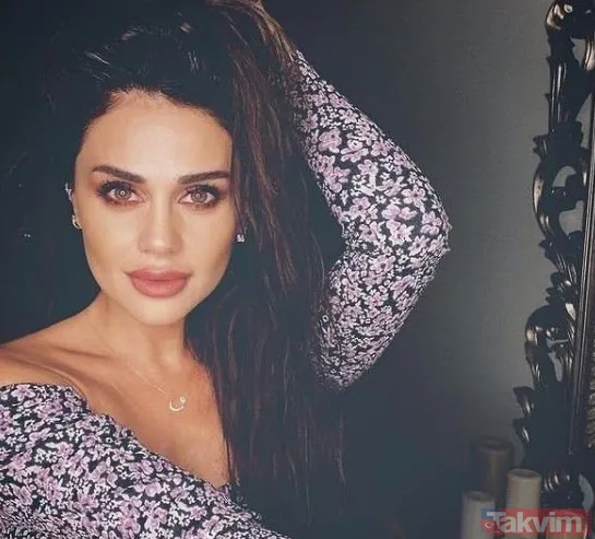 Aleyna Tilki’nin şiş dudakları olay oldu! Son halini gören dönüp bir daha baktı “Ajda Pekkan olma yolunda” - 12