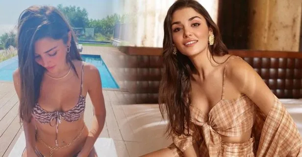 Hande Erçel’in estetiksiz hali harıl harıl doktor arattırıyor!