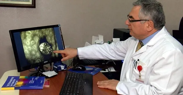 Sağlık Bakanlığından ‘uyuz’ açıklaması!