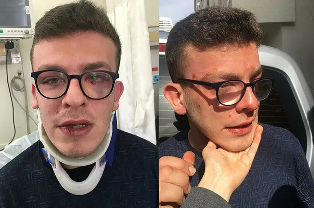 Avcılar'da skandal olay! Taha Alper Behrem isimli otizmli genci öldüresiye dövdü