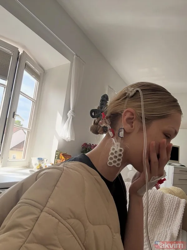 Lyme hastalığıyla mücadelede eden Bella Hadid hastane odasındaki son halini paylaştı! - 2