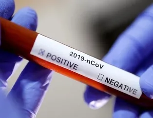 Kovid-19 hasta sayısında rekor iyileşme