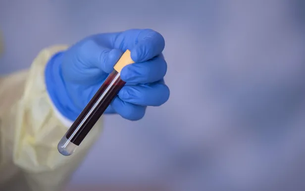 6-agustos-korona-tablosu-koronavirus-son-durum-tablosu-vaka-olum-ve-iyilesen-kac-kisi-oldu-1596725671660.jpg 6 Ağustos korona tablosu! Koronavirüs son durum tablosu vaka, ölüm ve iyileşen kaç kişi oldu?-4