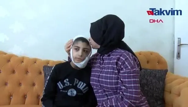 Yüzünde çıkan tümör sonrası kapanmayan yara her gün büyüyor