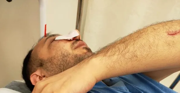 Hasta yakını sağlık çalışanını darp etti