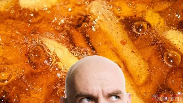 Kelliğin merhemi bulundu hem de bakın ne! Çare yine mutfaktan çıktı ama 40 yıl düşünsek aklımıza gelmez meğer... - 1