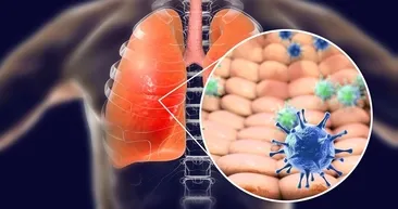 Bilim insanları açıkladı! İşte ilk günden son güne kadar koronavirüs belirtileri