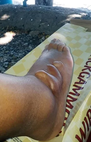 Ayağına düşen 'aslan balığı' öldürüyordu