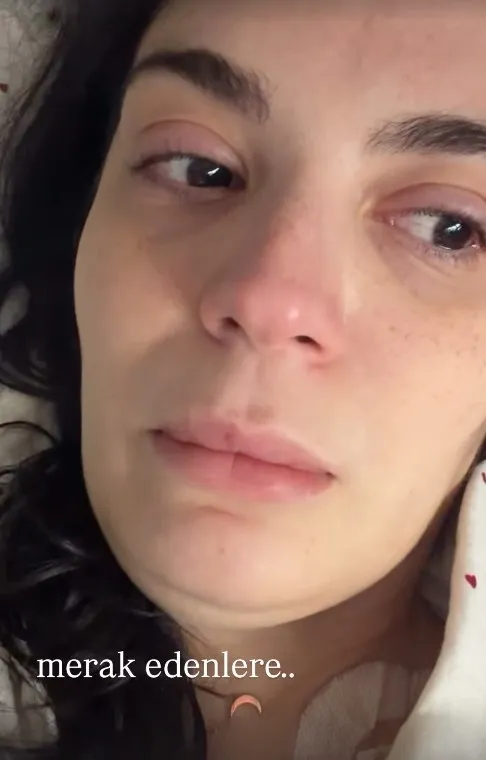 7-kez-ameliyat-olan-asli-bekiroglundan-gozyaslariyla-paylasti-1776419683502.jpg 7. kez ameliyat olan Aslı Bekiroğlu'ndan gözyaşlarıyla paylaştı: “Taburcu olacağımı sanmıştım”-3