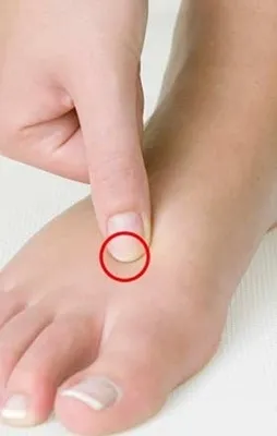 Bu noktalara basınçla ağrılardan kurtulun!