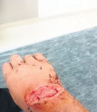 1775416382386.jpeg Gaziantep'te sosyal medya tanışıklığı kabusa döndü: Beyin kanaması geçiren kadından adalet feryadı-1