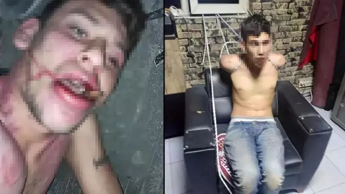 Antalya'da korkunç olay! Günlerce işkence ettiler! Dişleri söküldü böcek yedirildi! Çalışan kabusu anlattı