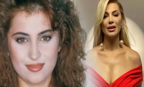 Songül Karlı estetikle komple yüzünü değiştirmiş görenler tanıyamadı! 'Estetiğim yok' diye ortalarda dolaşan Songül Karlı...-2