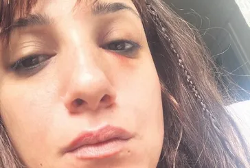 Taksim Eğitim ve Araştırma Hastanesi'nde ortalık karıştı! Epilepsi geçiren kadına kelepçe şoku...