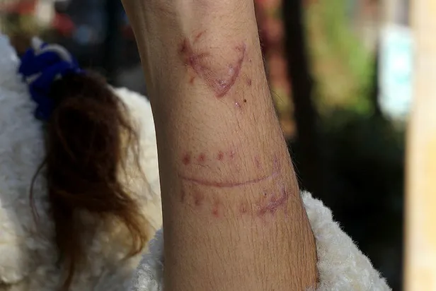 Antalya'da eski eş vahşetinden kurtulan Oya Aydoğdu: Aklıma Emine Bulut geldi-3