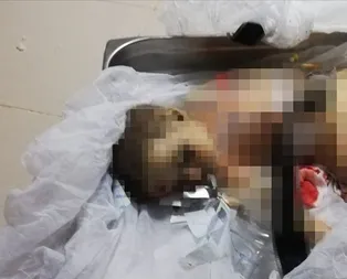 9 aylık Muhammed bebek ve 11 yaşındaki Elif terör örgütü YPG/PKKnın kurbanı oldu