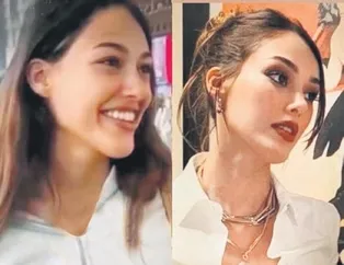 Estetikleri ’çene’ yordu!