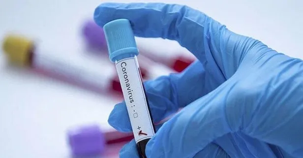 Çad’da ilk koronavirüs vakası görüldü