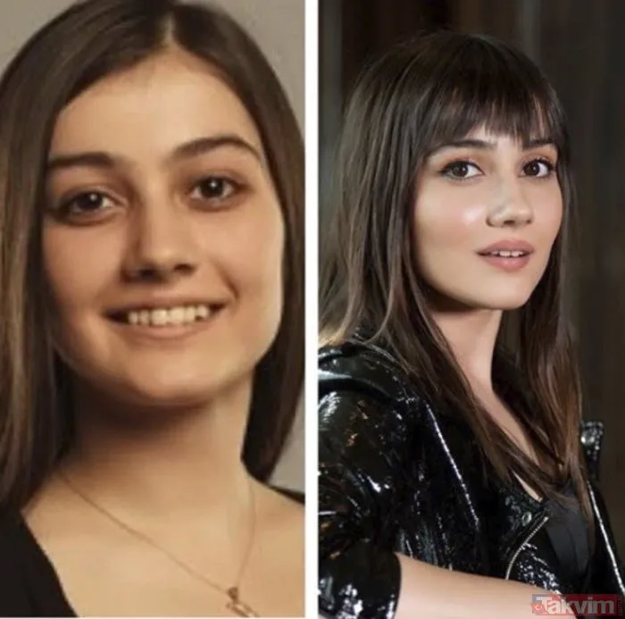 Sevda Erginci�nin eski halini görenler şaştı kaldı Ünlülerin estetiksiz