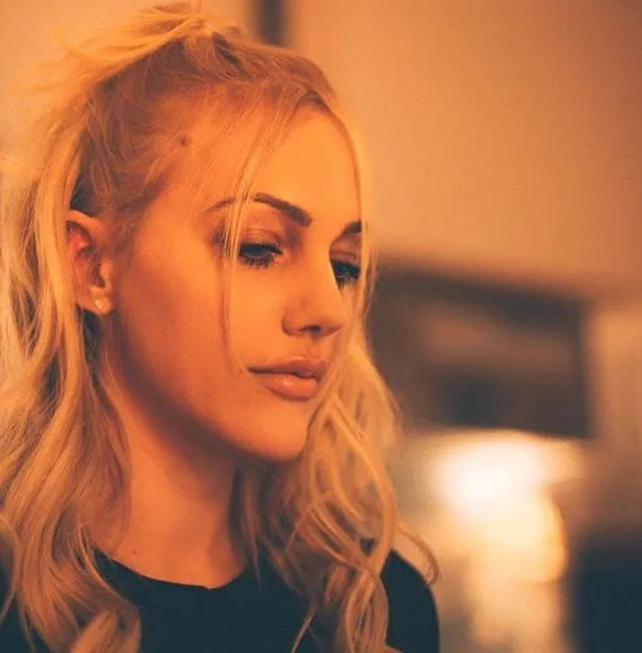 Meryem Uzerli, 'Hollywood yanağı' yaptırdı-11